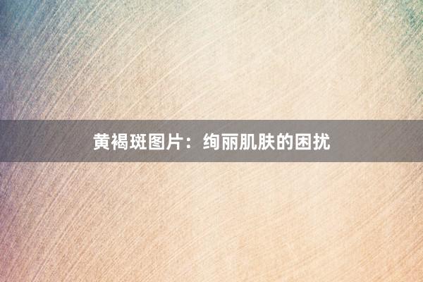 黄褐斑图片：绚丽肌肤的困扰